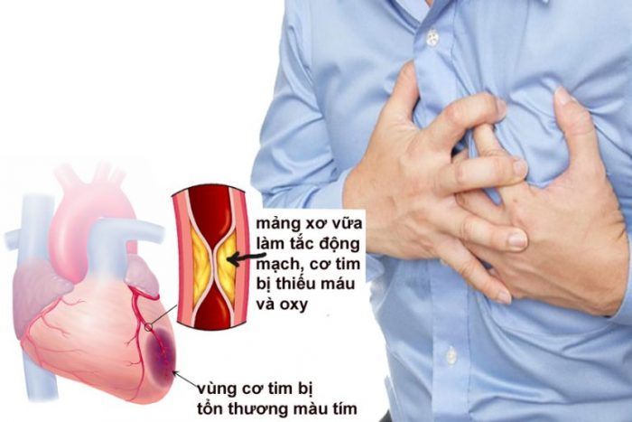 Bệnh nào thường gây ra máu nhiễu mỡ